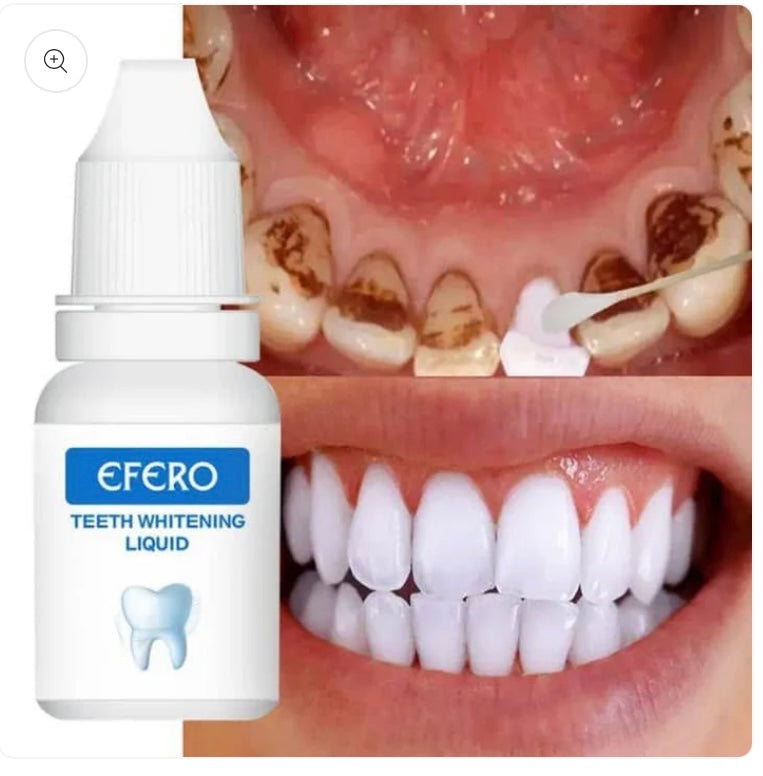 Blanchissement de Dent